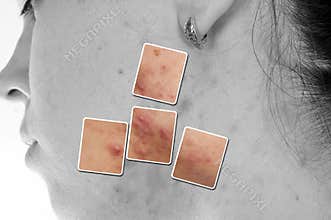 Skin problems