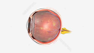 Diabetic retinopathy is an eye condition that can cause vision loss and blindness in people who have diabetes