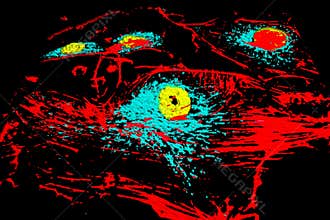 Bovine pulmonary arthery cells
