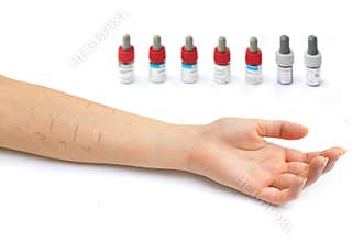 Allergy test