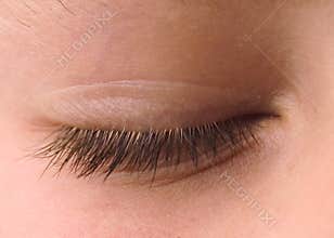 Closed Eye