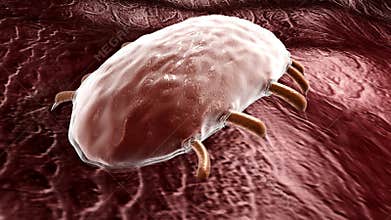 Mites live on the surface and absorb nutrients, skin and scalp surface, mite removal device, sterilization liquid advertisement