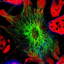 Cells under microscope