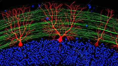 Cerebellar Cortex Granule Cell Layer Parallel Fiber Confocal