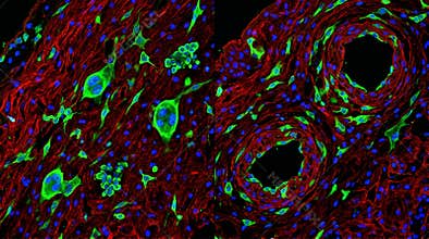 Trophoblast Giant Cell Invasive Front Placenta Confocal