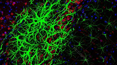 Astrocyte Reactive Gliosis GFAP Upregulation Confocal
