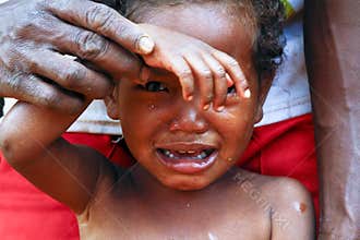 Crying girl with tear on cheek - poor african child