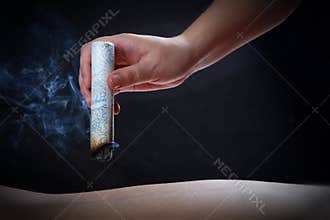 Acupuncture and moxibustion--a traditional chinese medicine method