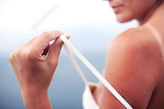 Sunburned female body
