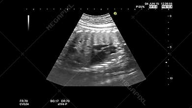 High quality ultrasound echography check. Gynecological medical examination. 33 weeks old pregnancy