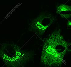 Mesenchymal stem cells