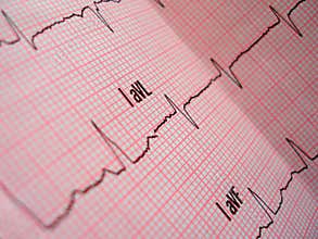 Heart analysis