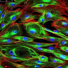 Confocal microscopy of fibroblast cells
