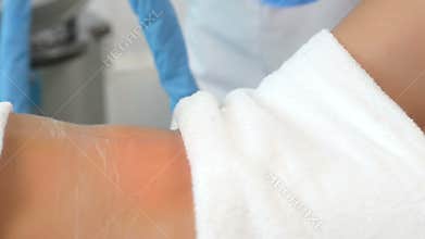 Cavitation Treatment