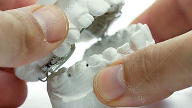 dental appliance doctor teeth hands