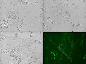 Microscopic view of yarrowia yeast