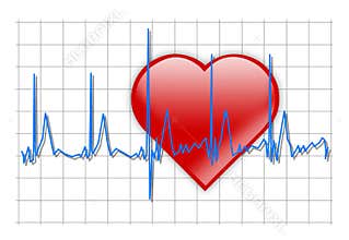 Heart beat