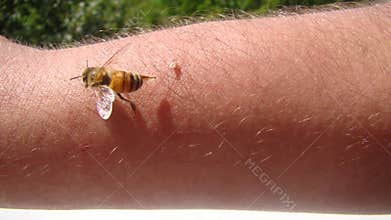 Bee : apis mellifera. treatment by honey bee sting. closeup honey bee stinging a hand. close up bee worker. insects, insect, anima