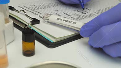 Scientific expert analyzes samples after the crisis of listeriosis caused by meat stuffed