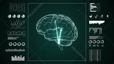 Medical UHD abstract animation. Laboratory dashboard interface. Human brian study on diagnostic computer display