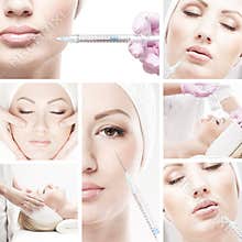 A collage of images with young woman on a botox procedure