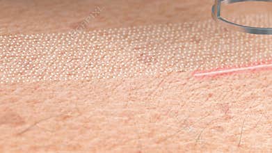 Old wrinkled skin surface laser resurfacing macro, 4k looped switch