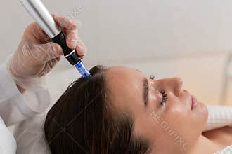 Trichologist doing woman improve hair growth procedure, dermapen microneedling, vitamin injections