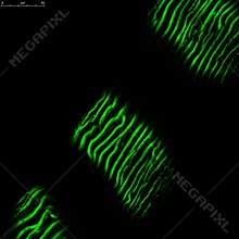 Cardiac muscle