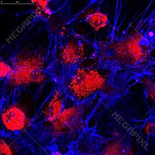 Fibroblasts (skin cells) labeled with fluorescent dyes