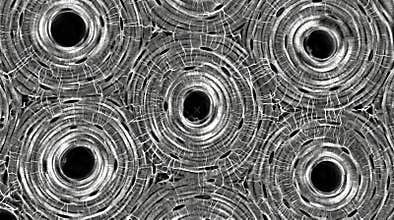 Cortical Bone Osteon Haversian System Confocal Reflection