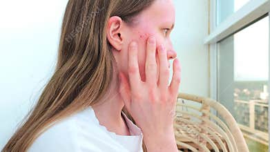 Woman touches cheek showing skin irritation and redness at home
