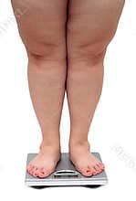 Women legs with overweight