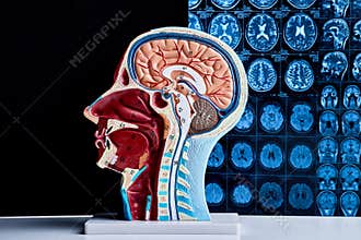 Brain cross section anatomical model beside magnetic resonance imaging scans used for neurological examination, clinical diagnosis