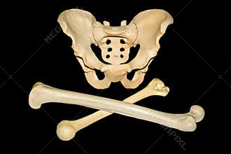 Cross-Bones