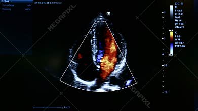 Colourful footage of homan heart ultrasound monitor