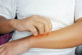 Person scratching at itchy skin on their arms