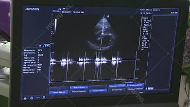 Medical ultrasound scan heart Echocardiogram