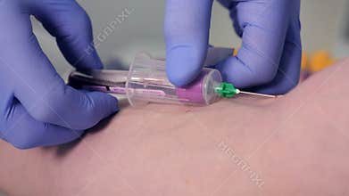 A patient gives vein blood sample at clinic. Creepy scene. 4K.