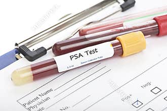 PSA Test