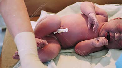 Nurse on gloves cut, tie up umbilical cord to newborn crying baby in maternity hospital after birth