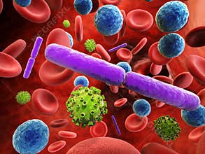 Blood infection with bacteria and virus cells