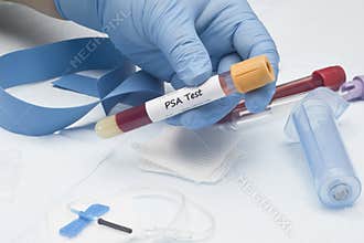 PSA Test