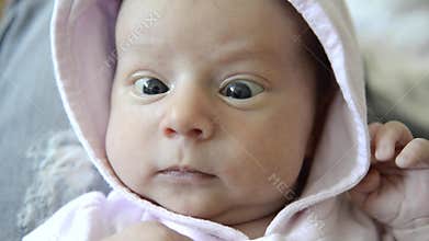 Cross eyed