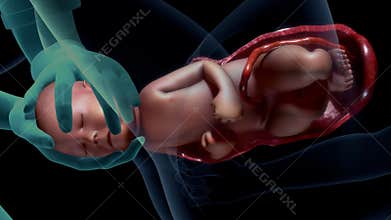 Normal labor and vaginal birth