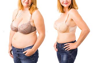 Woman before and after weight loss